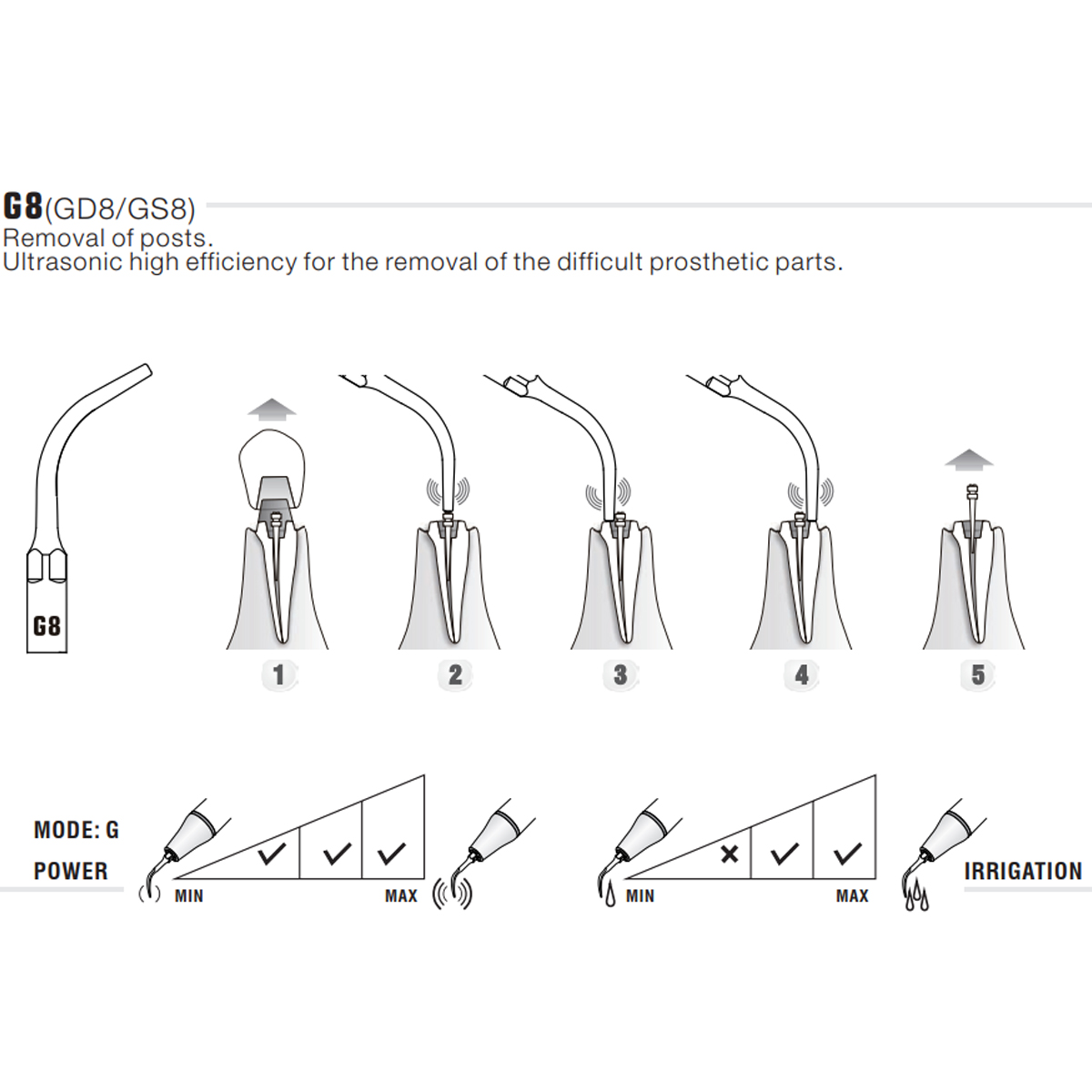 Woodpecker Scaler Tip G8 for UDS & EMS Scalers