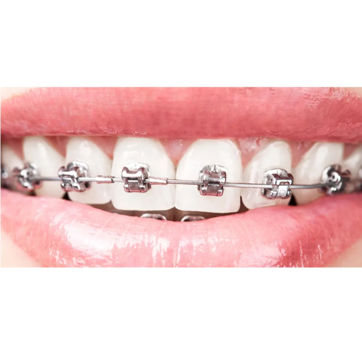 OSL Copper NiTi Ovoid Form Archwires - Rectangular (Pack Of 10)