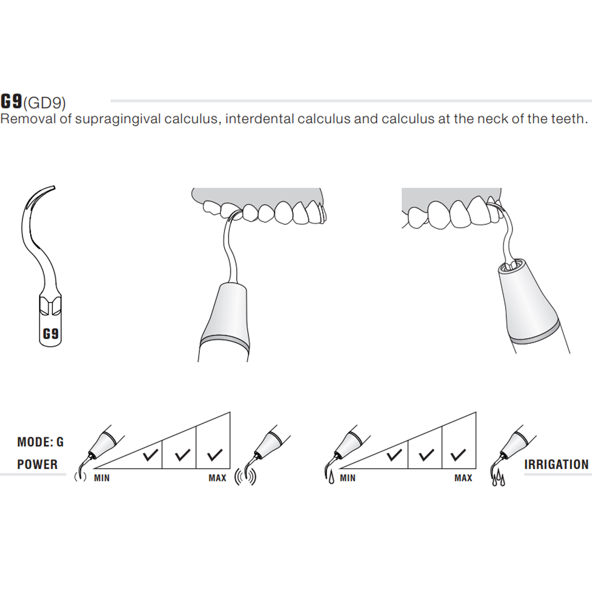 Woodpecker Scaler Tip G9 for UDS & EMS Scalers