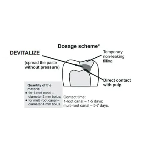 DPI Pulpdev Paste Pulp Devitalizer Paste (FP013)