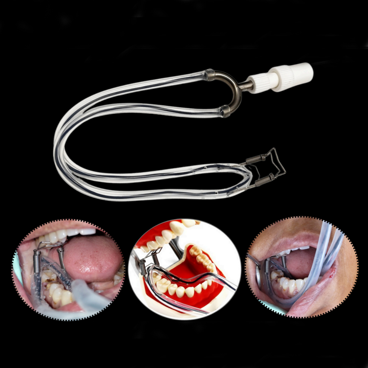 HN Dental Retra-Vac Multi-Functional Salivary Suction Tube