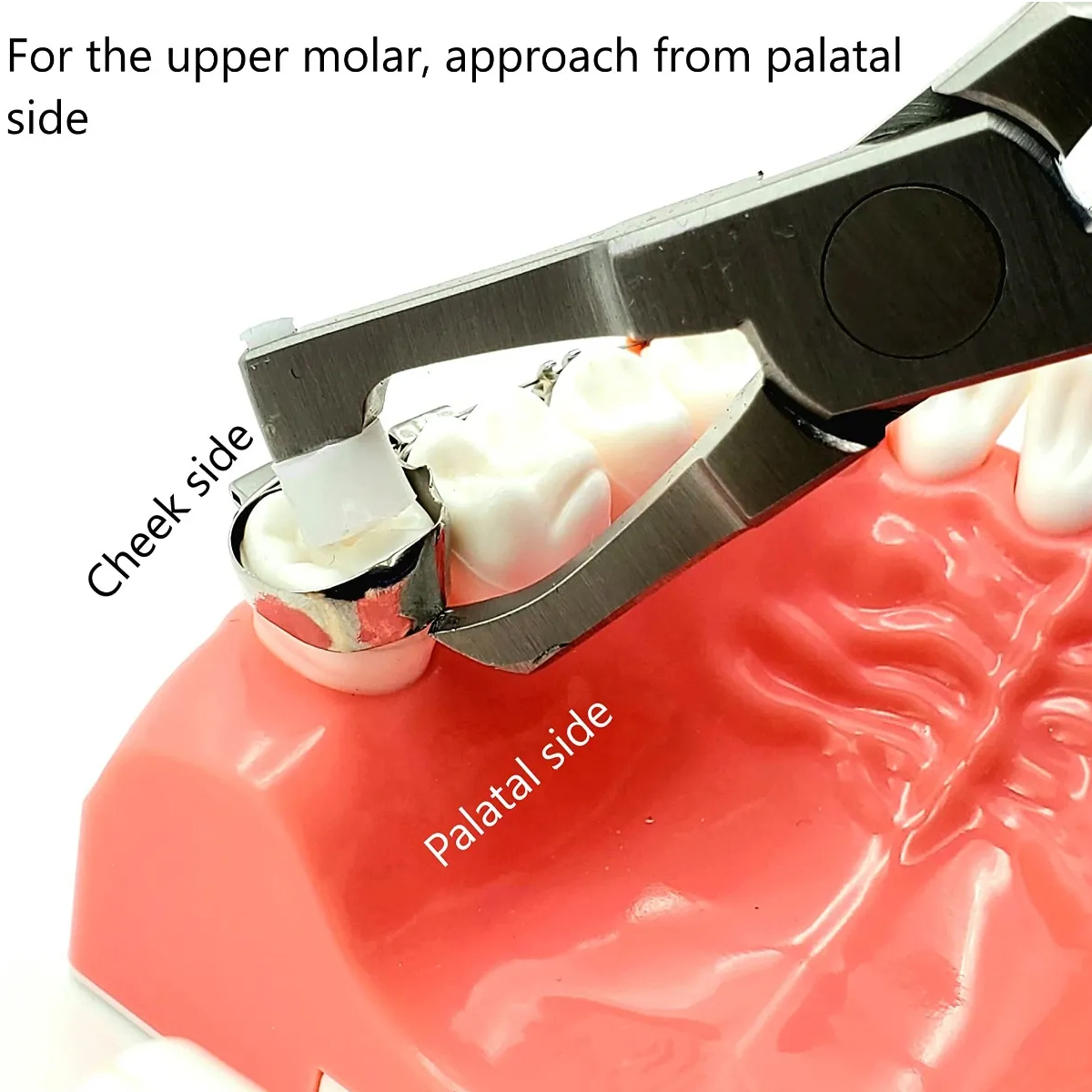 Gdc Posterior Band Remover # Long (Tc) (3000/50Tc)