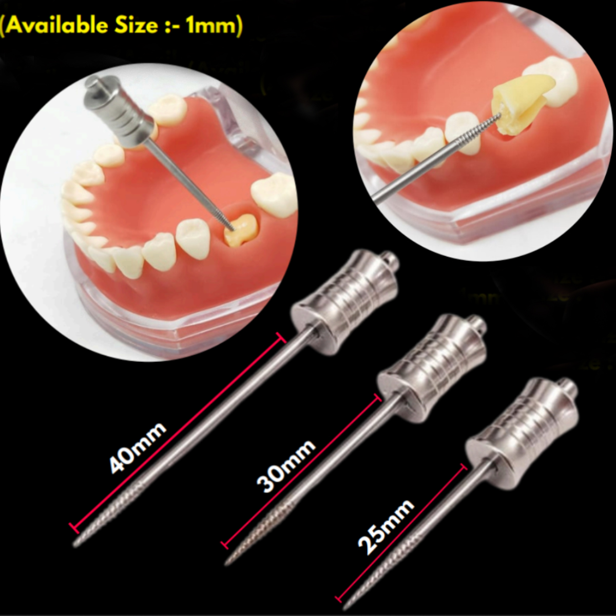 HN Dental Root - Buddy Root Remover System (Pack Of 3)