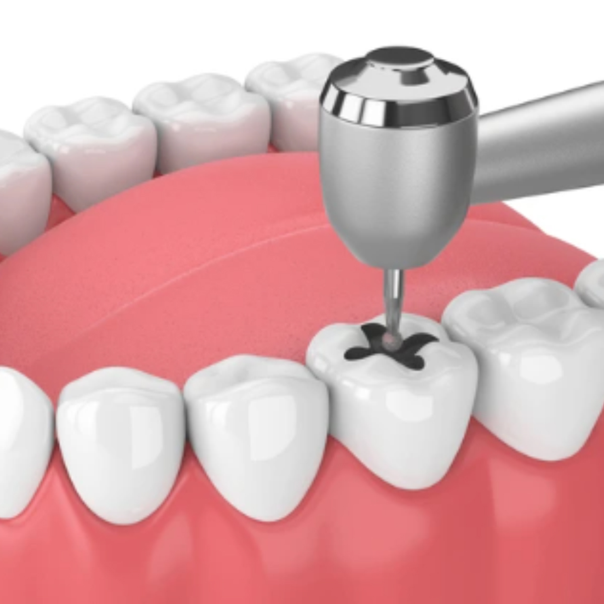 Pivo Round Carbide Contra-angle Burs - RA (Pack Of 5)