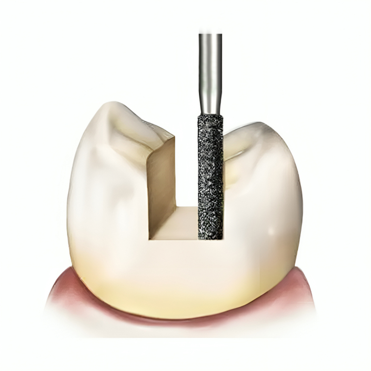 Pivo Straight Fissure Flat End Plain Cut Carbide Contra-angle Burs - RA (Pack Of 5)