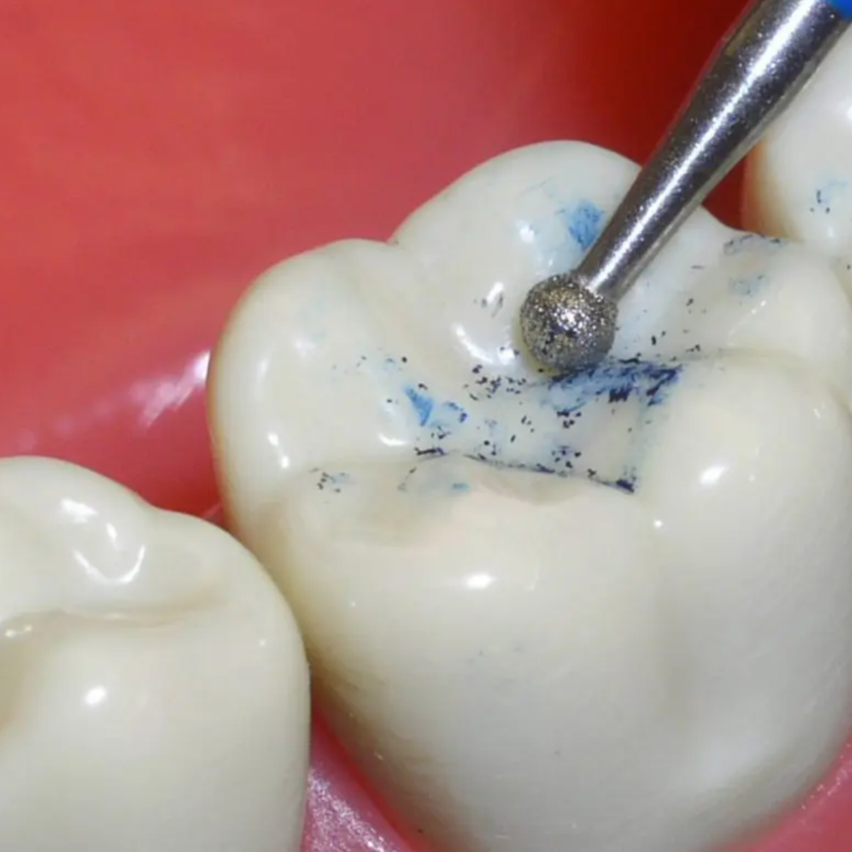 Pivo Micromotor Burs Kit - Contra-Angle Handpiece (Set Of 4)