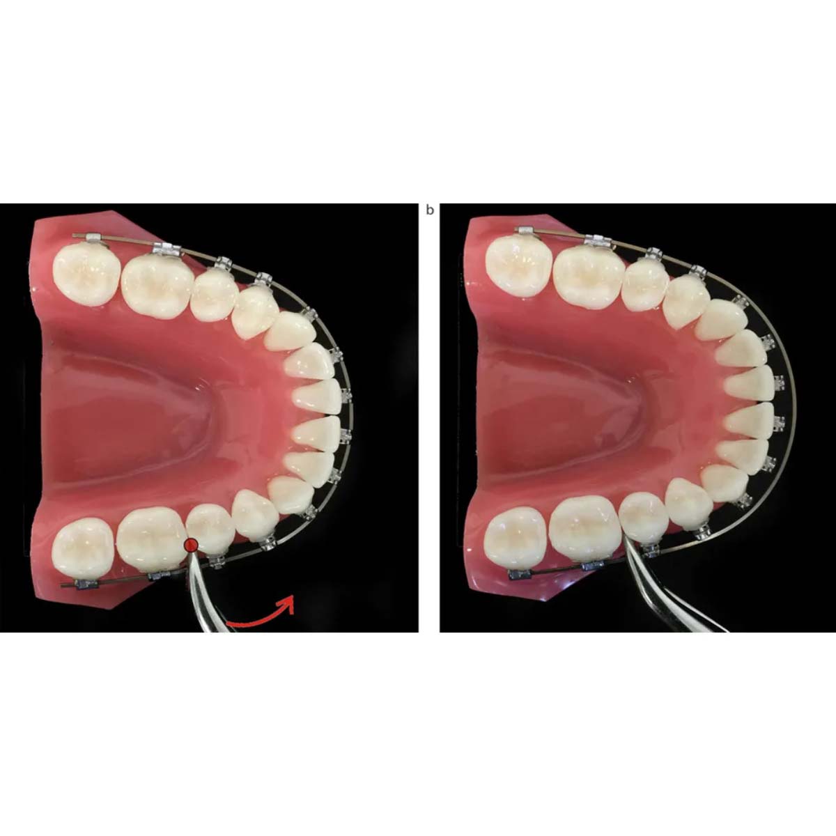 OrthoMetric Flexy NiTi Super Elastic Esthetic Rhodium Plated Archwires - Round (1/Pk)
