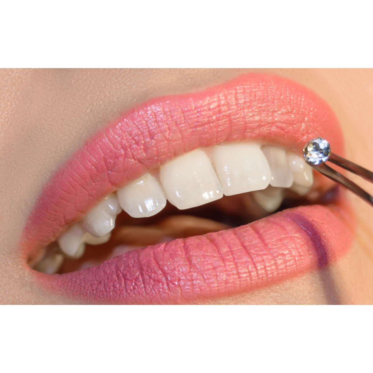 Tooth Jewellery (Set of 5)- White Crystals