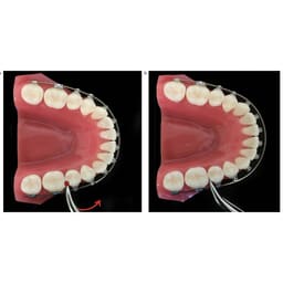 OrthoMetric SS Archwires - Square (10/Pk) - 4
