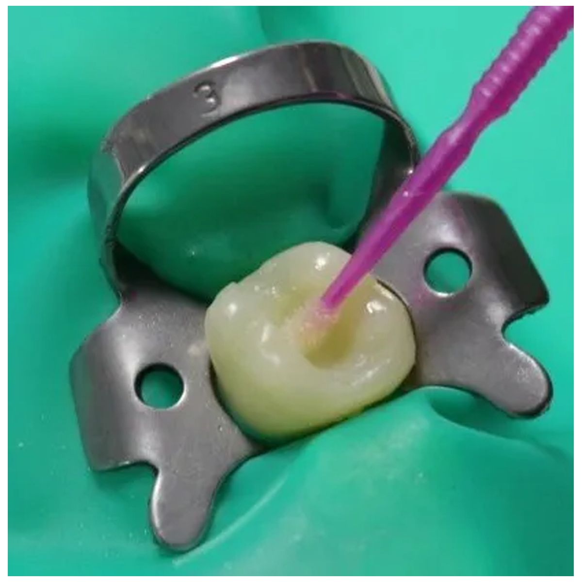 DPI Curex Bond Universal Dental Adhesive