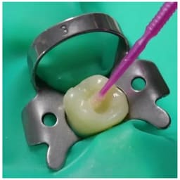 DPI Curex Bond Universal Dental Adhesive (FC049) - 4