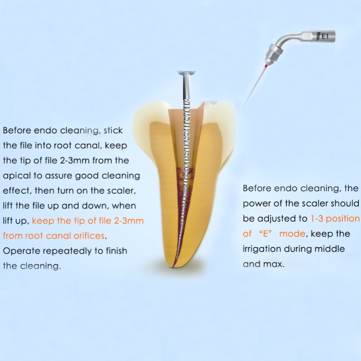 Woodpecker Scaler Tip E1 for UDS & EMS Scalers      