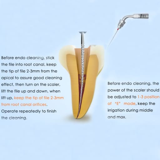 Woodpecker Scaler Tip E1 for UDS & EMS Scalers