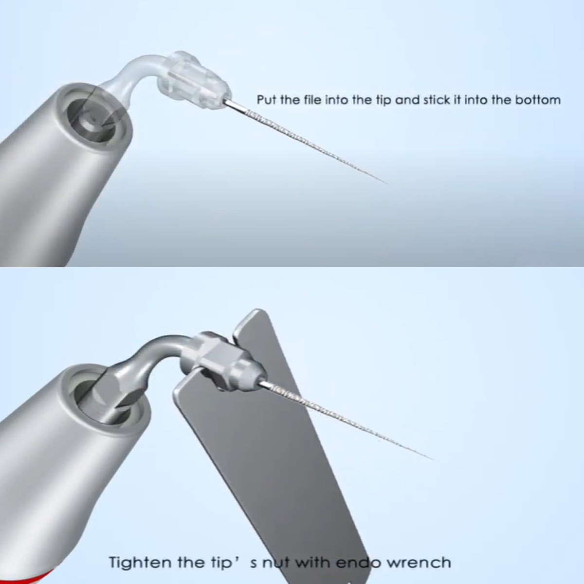 Woodpecker Scaler Tip E1 for UDS & EMS Scalers      