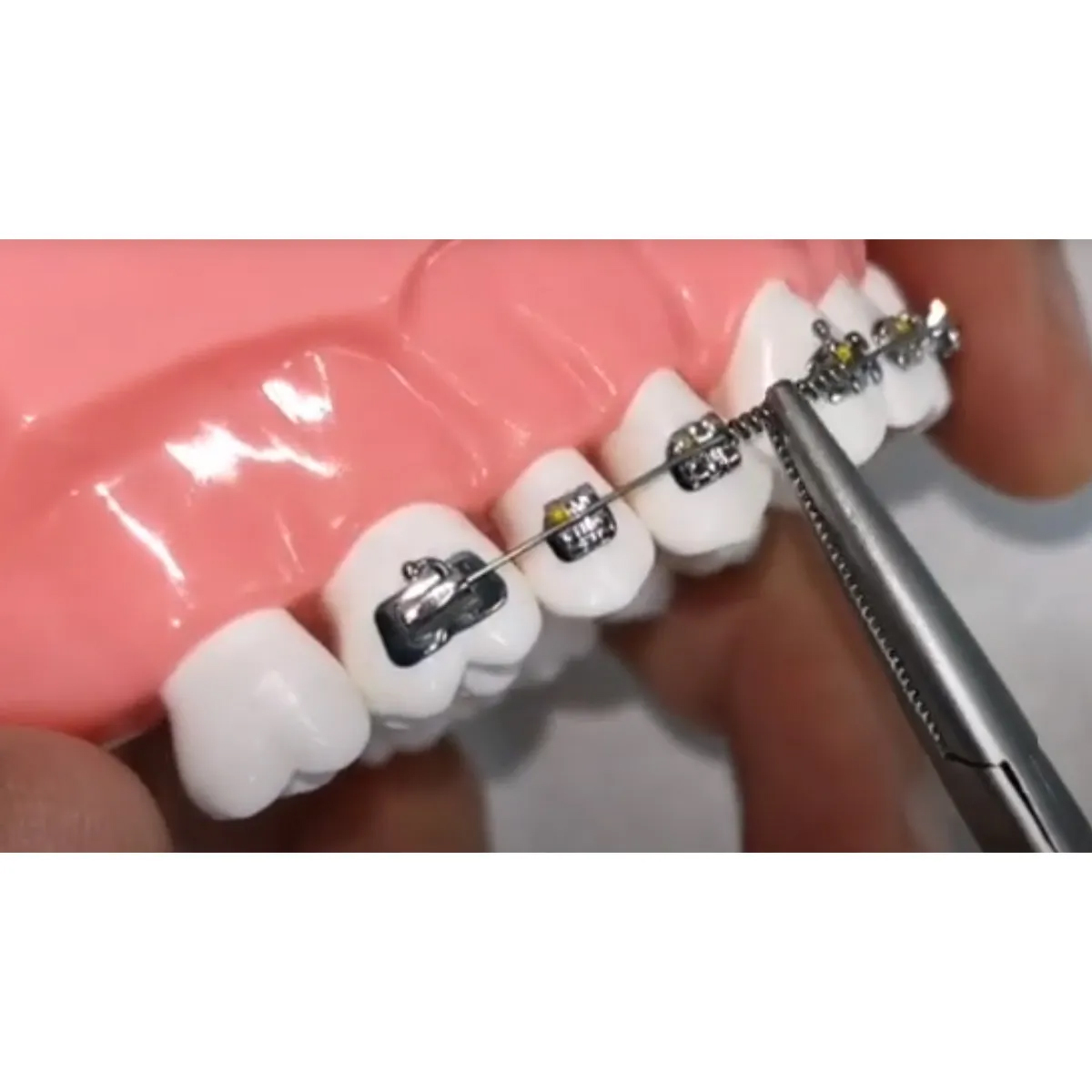 OrthoMetric Flexy NiTi Orthodontic Spring Open (Ø0.75mm X 178mm) - 35.20.0010