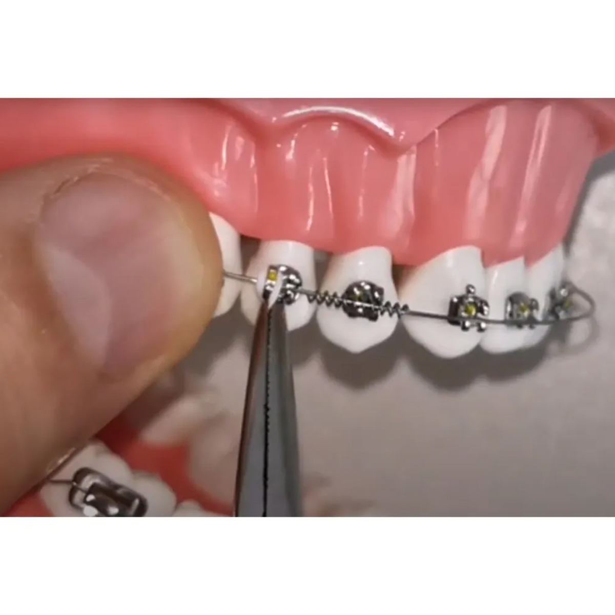 OrthoMetric Flexy NiTi Orthodontic Spring Open (Ø0.75mm X 178mm) - 35.20.0010