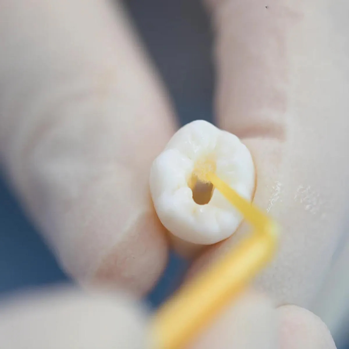 DPI Curex Bond 5G Dental Adhesive