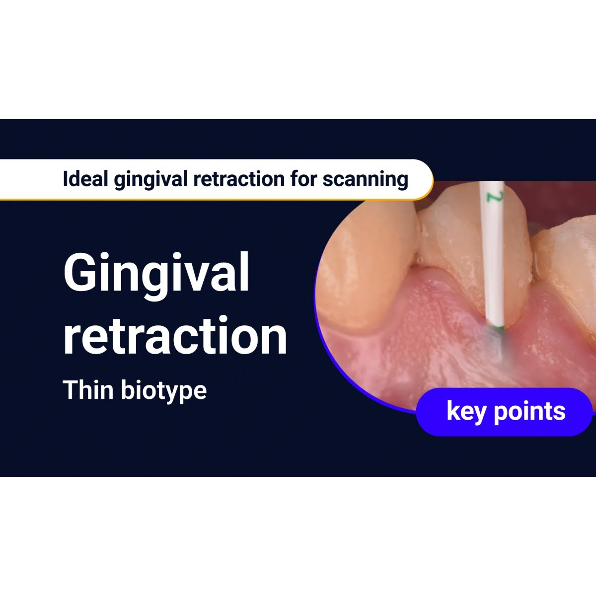 DPI Hemostatic Solution Gingival Retraction Solution