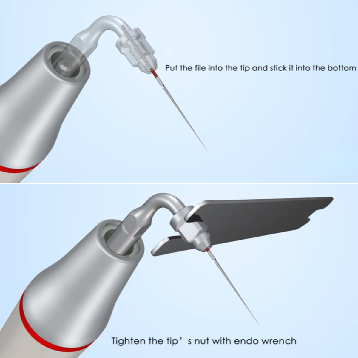Woodpecker Scaler Tip E2 for UDS & EMS Scalers
