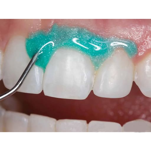 Prime Dental Gingisafe Light Cure Gingival Barrier Kit