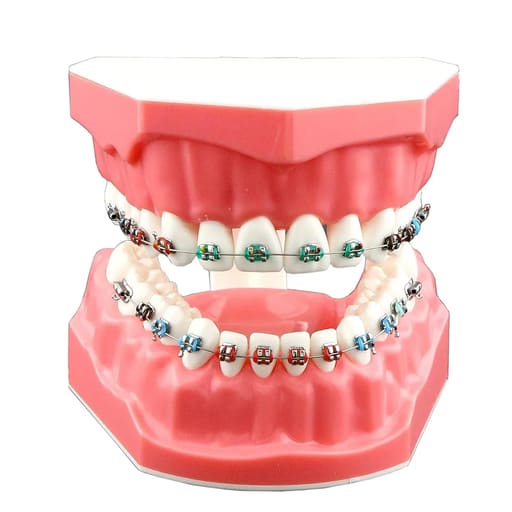 OSL Orthodontic Intraoral Elastics