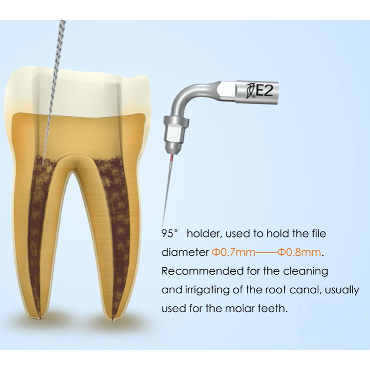 Woodpecker Scaler Tip E2 for UDS & EMS Scalers