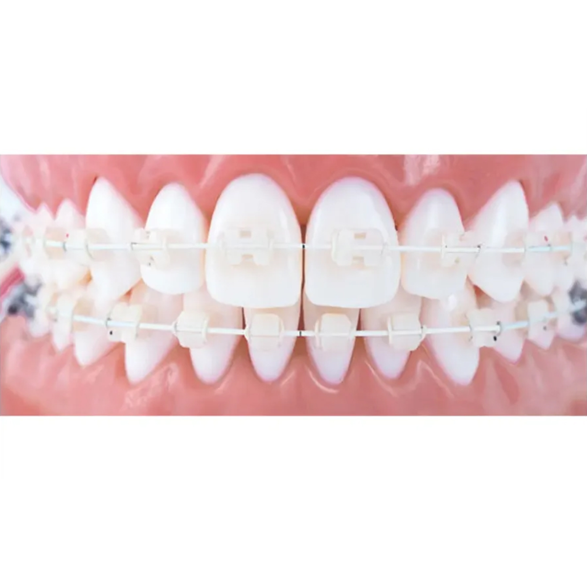 OSL NiTi Tooth Color Ovoid Form Archwires - Rectangular (Pack Of 5)