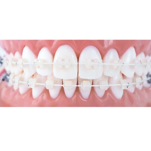 OSL NiTi Tooth Color Ovoid Form Archwires - Rectangular (Pack Of 5)
