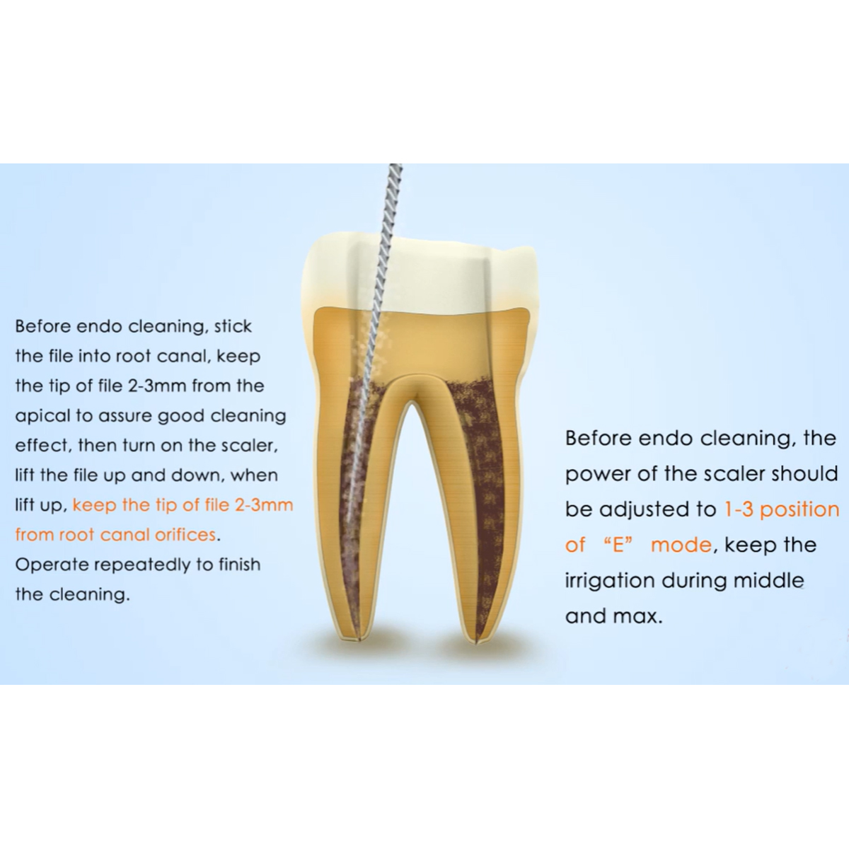 Woodpecker Scaler Tip E2 for UDS & EMS Scalers