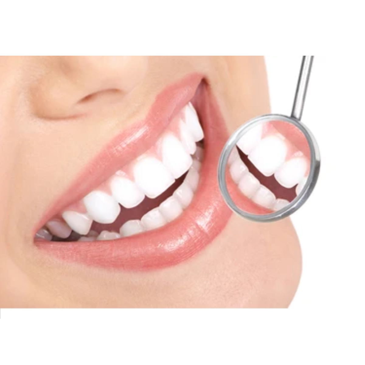 GI Dental Mouth Mirror Tops (Pk Of 10)