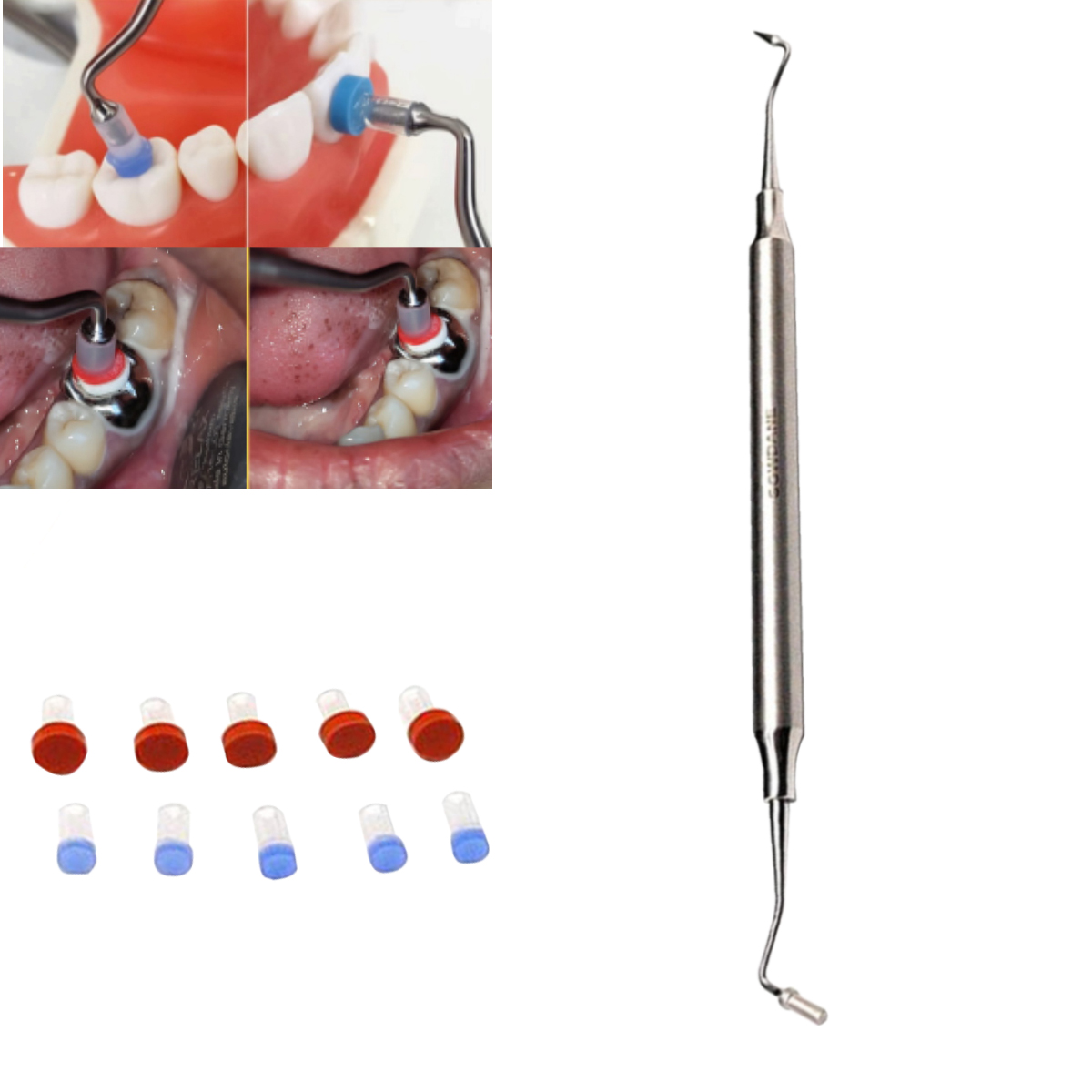 HN Dental Crown - O - Press