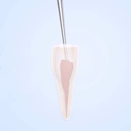 Woodpecker Scaler Tip E3 for UDS & EMS Scalers - 8