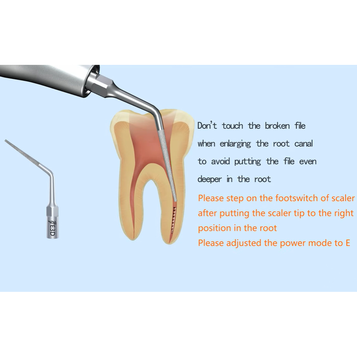 Woodpecker Scaler Tip E3D for UDS & EMS Scalers