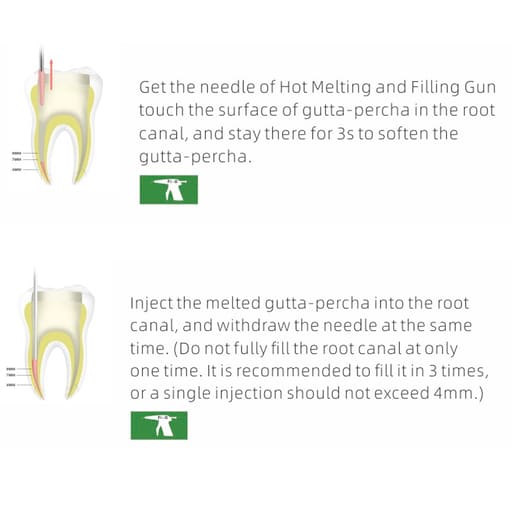 Woodpecker Fi-G Obturation Gun Tips