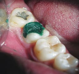 Maarc Pattern Wax - 6