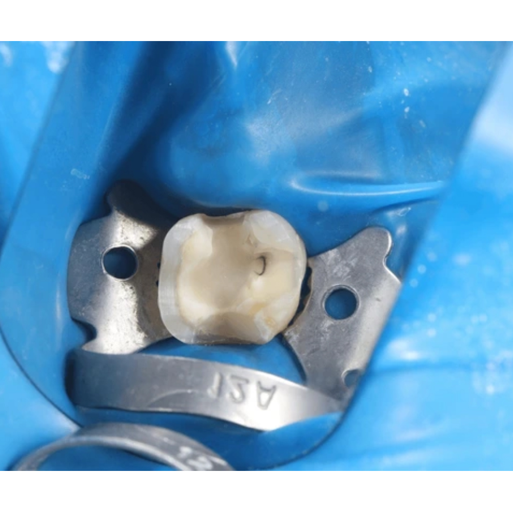 GDC Rubber Dam Clamp Adult 13a (Rdc13a)