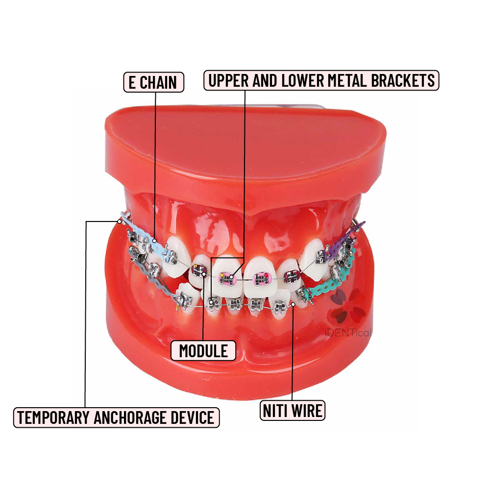 iDENTical Dental Orthodontic Models M3005