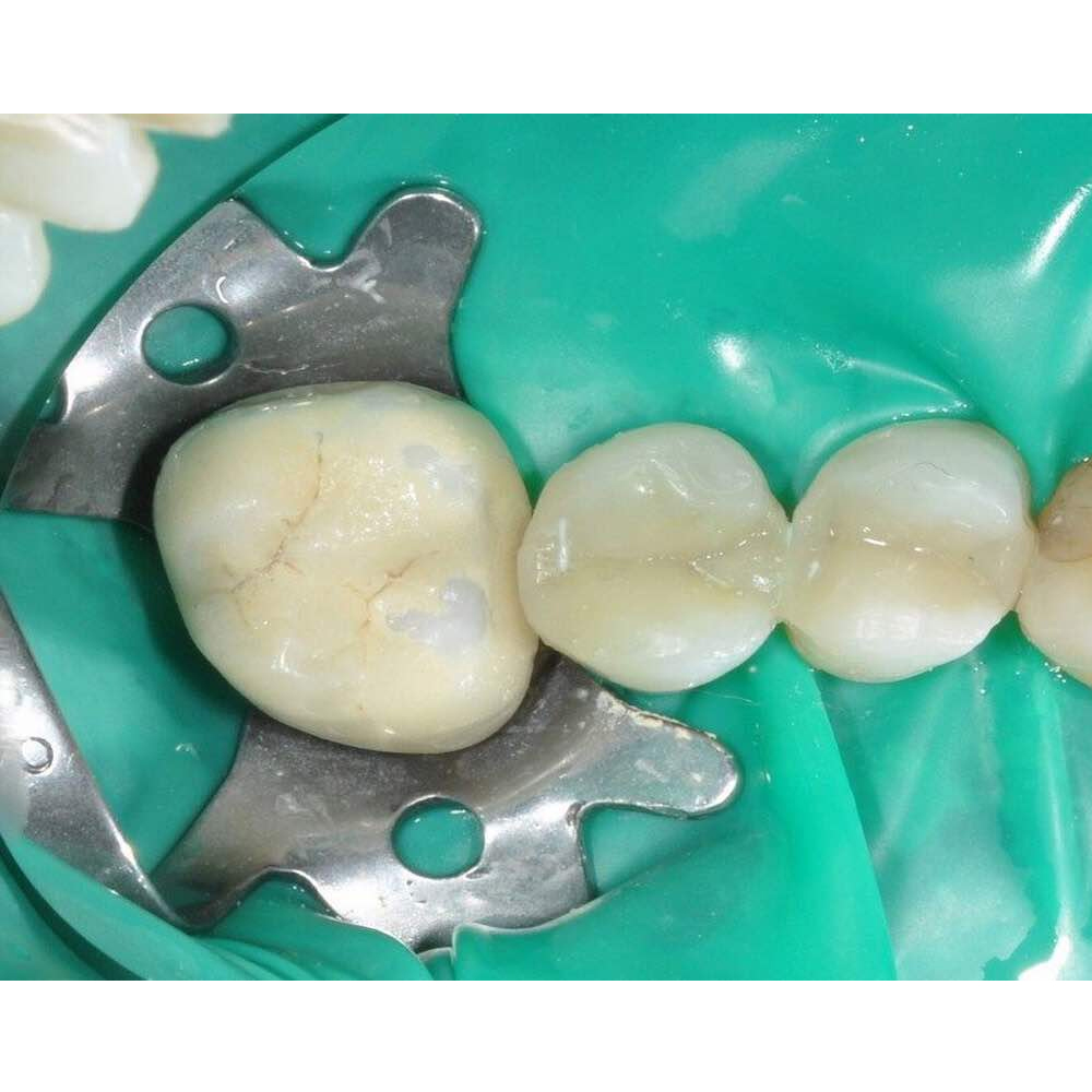 GDC Rubber Dam Clamp Adult 14a (Rdc14a)