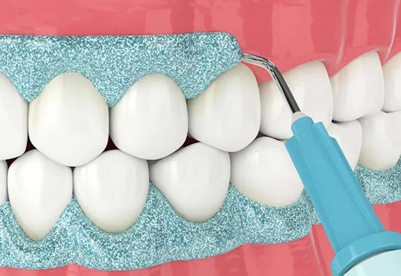 Maarc Blitz White Bleaching Kit (8801/001)