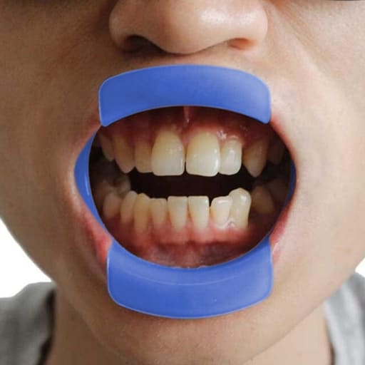 ET Dental Cheek And Lip Retractors