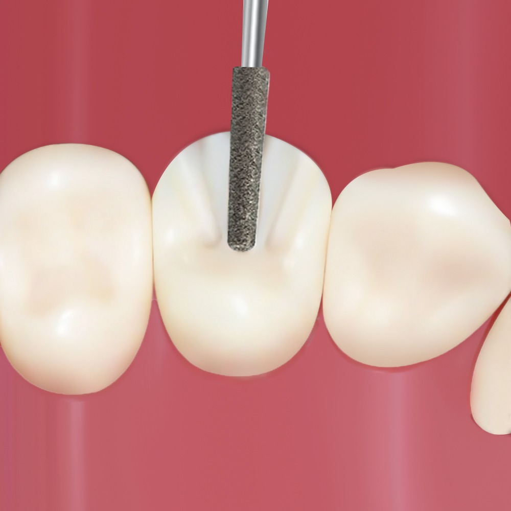 Frank Dental Tapered Round Diamond Bur FG TR (Made in Germany)