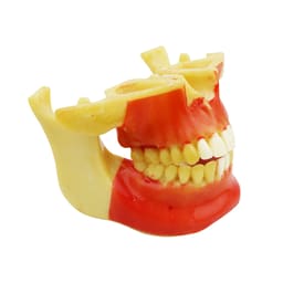 iDENTical Ortho Implant Practice with Soft Tissue Model M2031 - 2