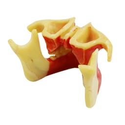iDENTical Ortho Implant Practice with Soft Tissue Model M2031 - 3