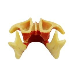 iDENTical Ortho Implant Practice with Soft Tissue Model M2031 - 4