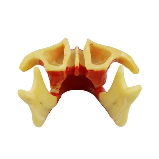 iDENTical Ortho Implant Practice with Soft Tissue Model M2031