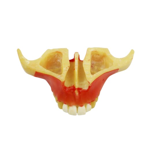 iDENTical Ortho Implant Practice with Soft Tissue Model M2031