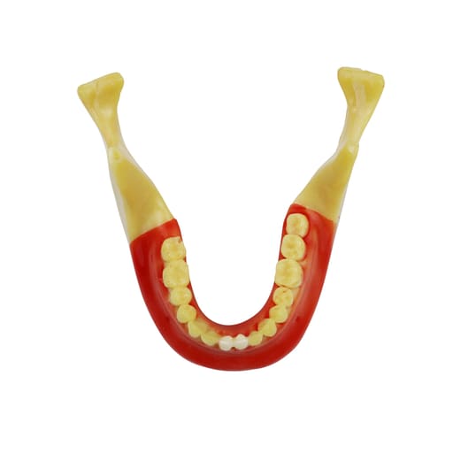 iDENTical Ortho Implant Practice with Soft Tissue Model M2031