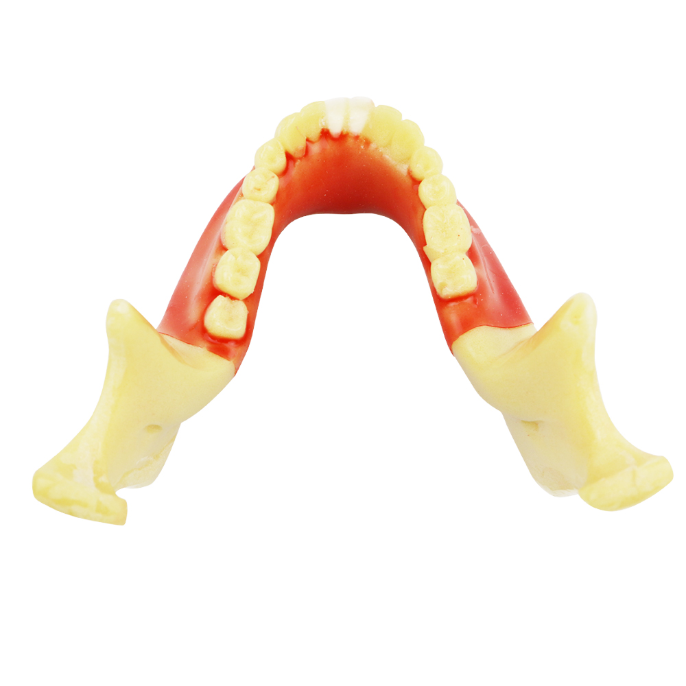 iDENTical Ortho Implant Practice with Soft Tissue Model M2031