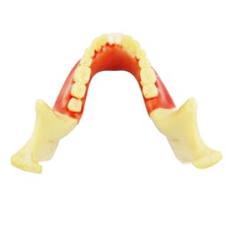 iDENTical Ortho Implant Practice with Soft Tissue Model M2031 - 7