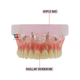 iDENTical Dental Model for Overdenture Maxilla M6001 - 8